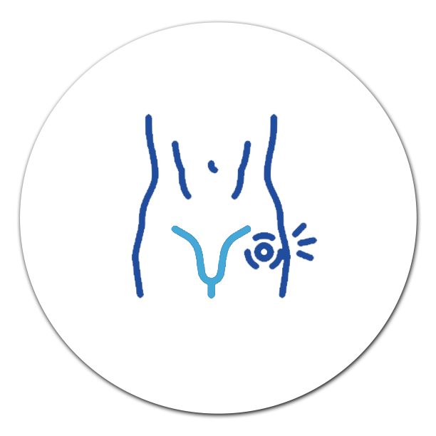 Varicocele